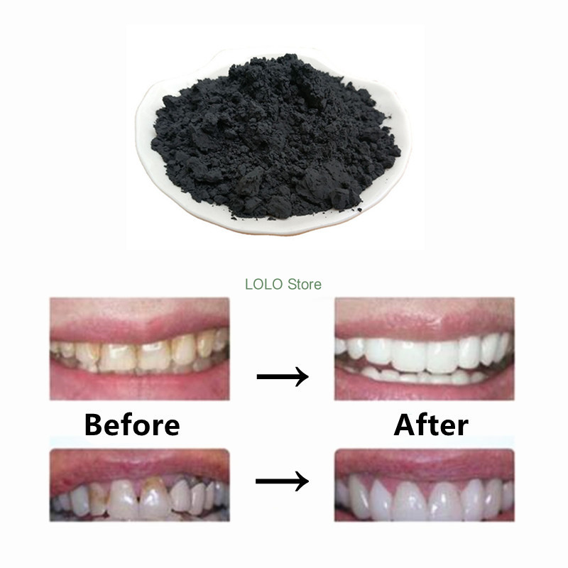 ピュアチャコールパウダー,活性炭パウダー,食品グレード,10 - Activated Charcoal Powder のレビューと価格